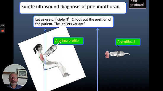 9.4. LUCIFLR _ subtle pneumothorax